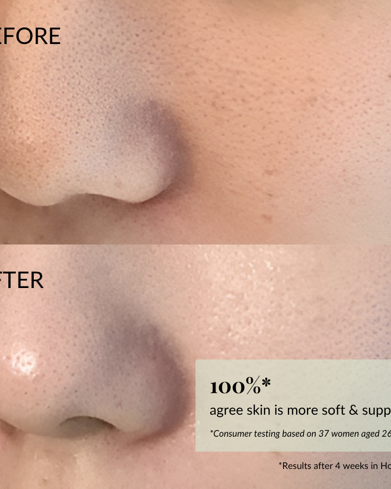 Close-up of a nose and cheek before and after using IREN Shizen FLOWERS IN BLOOM Antioxidant Water Cream; "after" image shows visibly smoother, softer skin with a 100% improvement claim in the corner. #show-lang-en