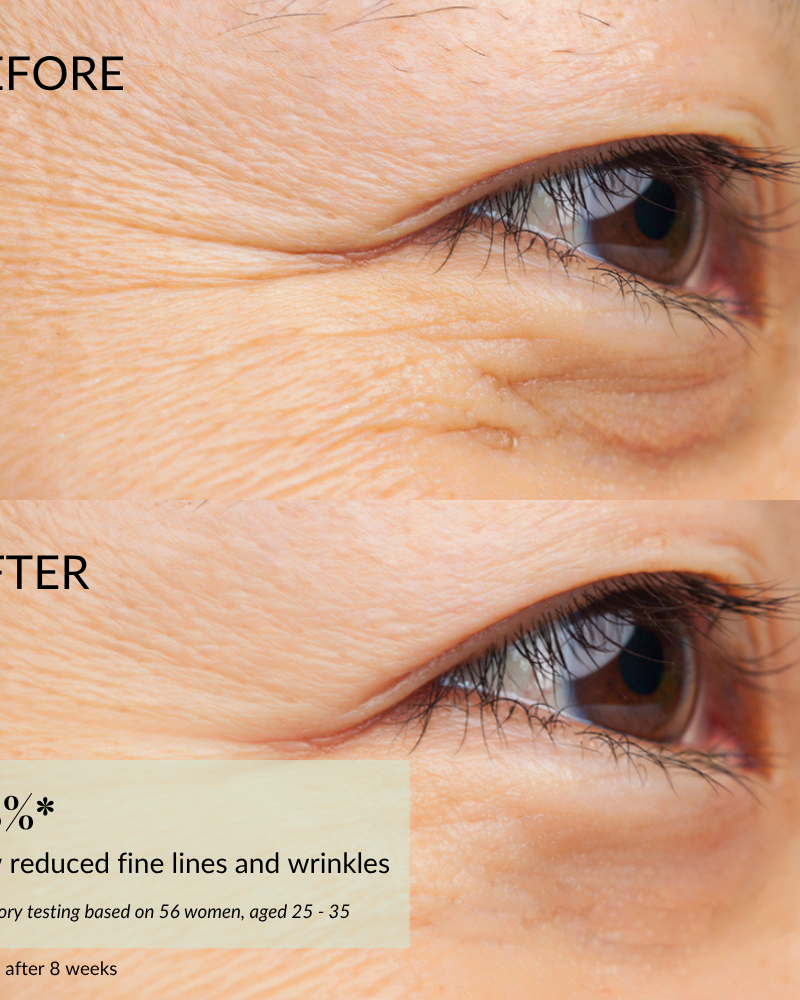 Close-up of eye area shows visible fine lines "before" and smoother, youthful skin "after"; text highlights reduced wrinkles with IREN Shizen FOREVER YOUNG Anti-Aging Serum infused with anti-aging peptides. #show-lang-en