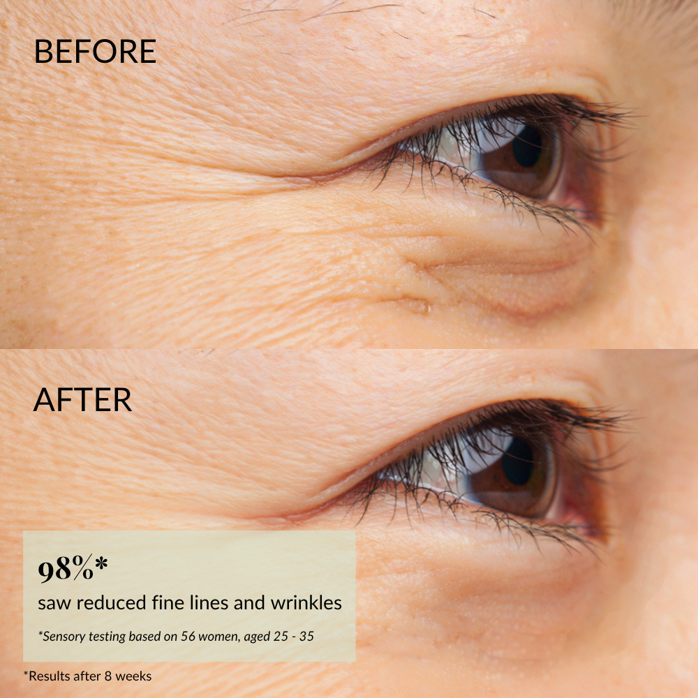 Close-up of eye area shows visible fine lines "before" and smoother, youthful skin "after"; text highlights reduced wrinkles with IREN Shizen FOREVER YOUNG Anti-Aging Serum infused with anti-aging peptides.