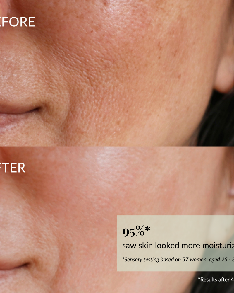 Close-up of a woman's cheek and mouth area shows plumper, less dry skin in the "after" image, demonstrating the moisturizing results of IREN Shizen QUENCH-UP Hydrating Serum.
#show-lang-en