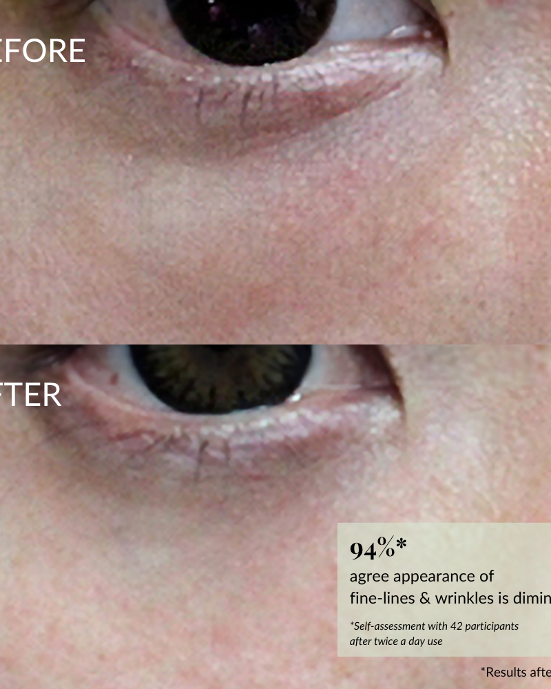 Close-up of skin near the eye, showing "before" with fine lines and "after" with smoother texture; highlights wrinkle improvement stats from using IREN Shizen's TIMELESS ELIXIR Multi-Lift Eye and Lip Cream, a potent anti-aging serum. #show-lang-en