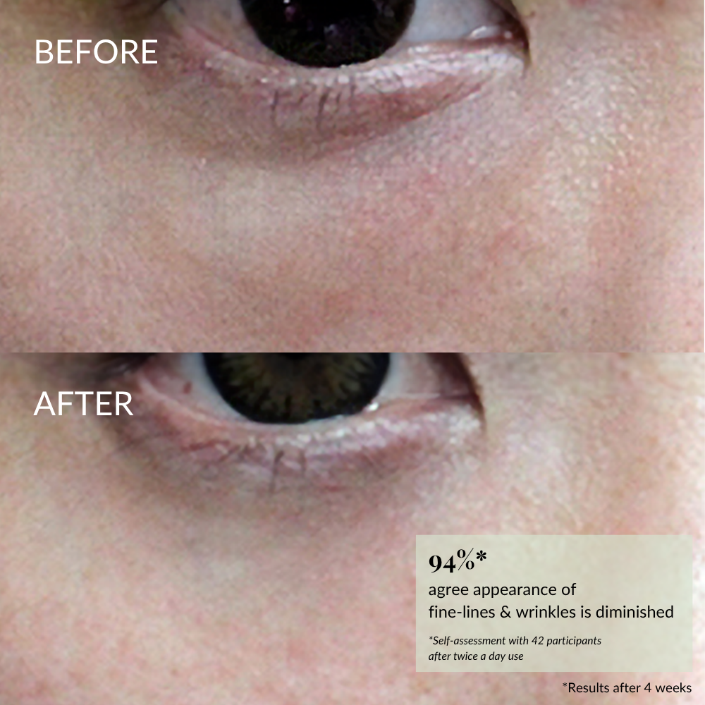 Close-up of skin near the eye, showing "before" with fine lines and "after" with smoother texture; highlights wrinkle improvement stats from using IREN Shizen's TIMELESS ELIXIR Multi-Lift Eye and Lip Cream, a potent anti-aging serum. #show-lang-en