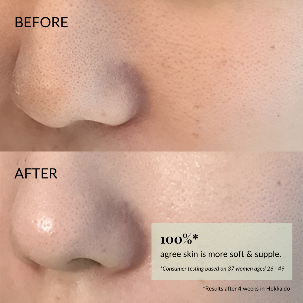 Close-up of a nose and cheek before and after using IREN Shizen FLOWERS IN BLOOM Antioxidant Water Cream; "after" image shows visibly smoother, softer skin with a 100% improvement claim in the corner.