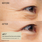 Close-up of eye area shows visible fine lines "before" and smoother, youthful skin "after"; text highlights reduced wrinkles with IREN Shizen FOREVER YOUNG Anti-Aging Serum infused with anti-aging peptides.