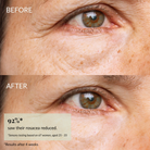 Close-up "Before" and "After" images reveal reduced redness, smoother skin, and brighter under-eyes after using IREN Shizen’s SKIN REBOOT Antioxidant Serum. Text highlights rosacea improvement and diminished dark circles.
